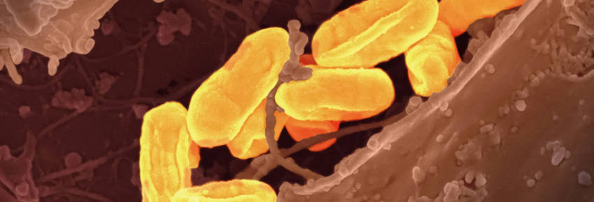 Fecal microbiota transplants (FMT) can kick start the growth of beneficial
bacteria which may have been absent from a person's gut microbiome.
