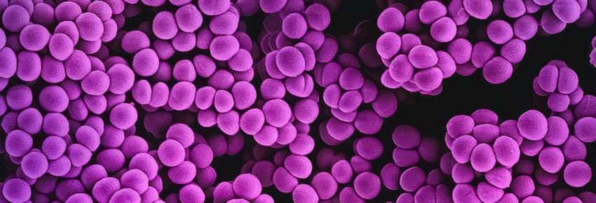 A surprising benefit of a healthy gut microbiome is increased cancer
survivability, as its spread is reduced when the gut has beneficial bacteria
in optimal proportions.